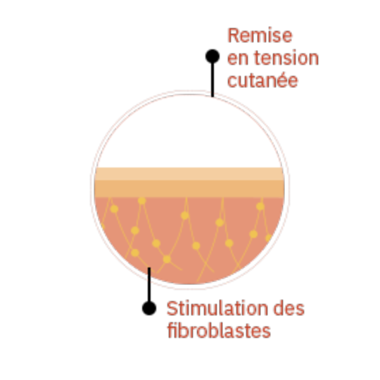 Energie thermique LDF